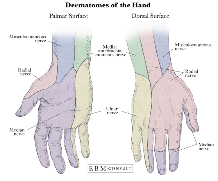 Median Nerve Dermatome Hand Dermatomes Chart And Map Sexiz Pix